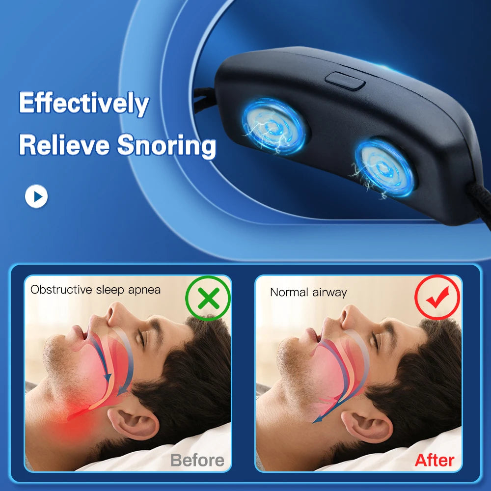 SnoreStop Smart Device